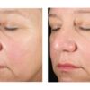 Alto Advanced Defense and Repair Serum - Image 6