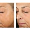 Alto Advanced Defense and Repair Serum - Image 7