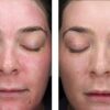 Sunbetter TONE SMART SPF 75 Sunscreen Lotion - Image 4