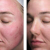 Sunbetter TONE SMART SPF 75 Sunscreen Lotion - Image 5